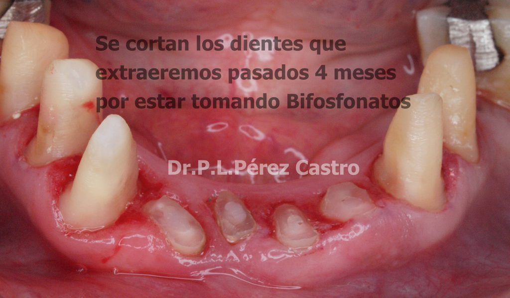 Rehabilitación Oral Completa: Dr. Pedro Luis Pérez Castro.
