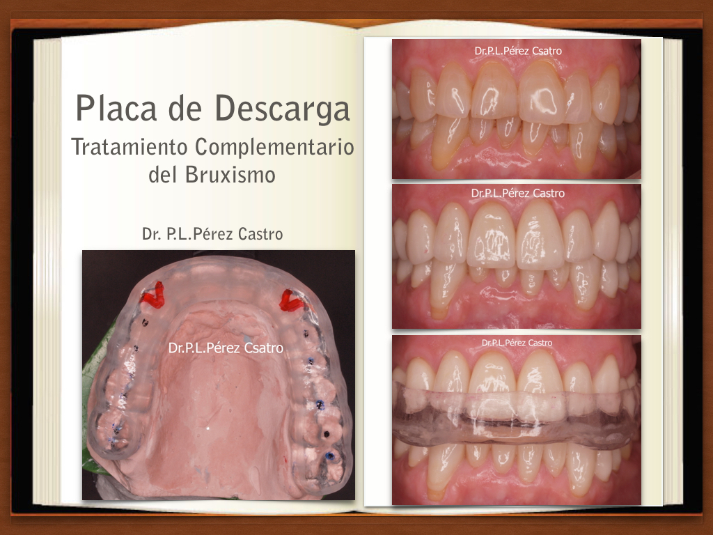 Placa de Descarga: Dr. Pedro Luis Pérez Castro