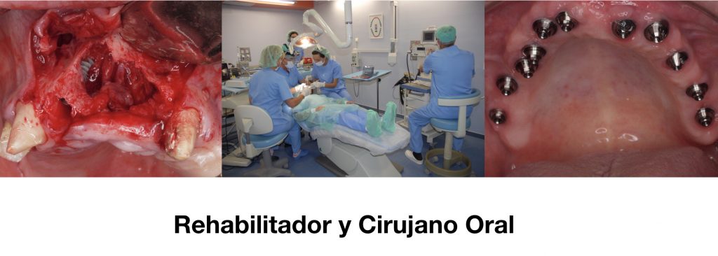 Formación en Rehabilitación Oral III : Dr. Pedro Luis Pérez Castro.
