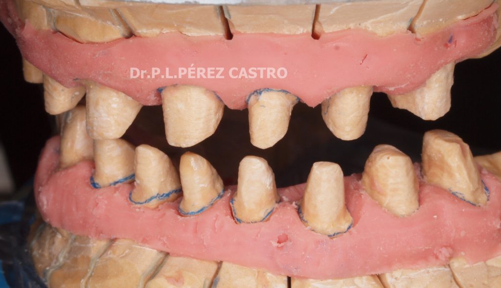 Laboratorio de Preprótesis Dental: Dr. Pedro Luis Pérez Castro.