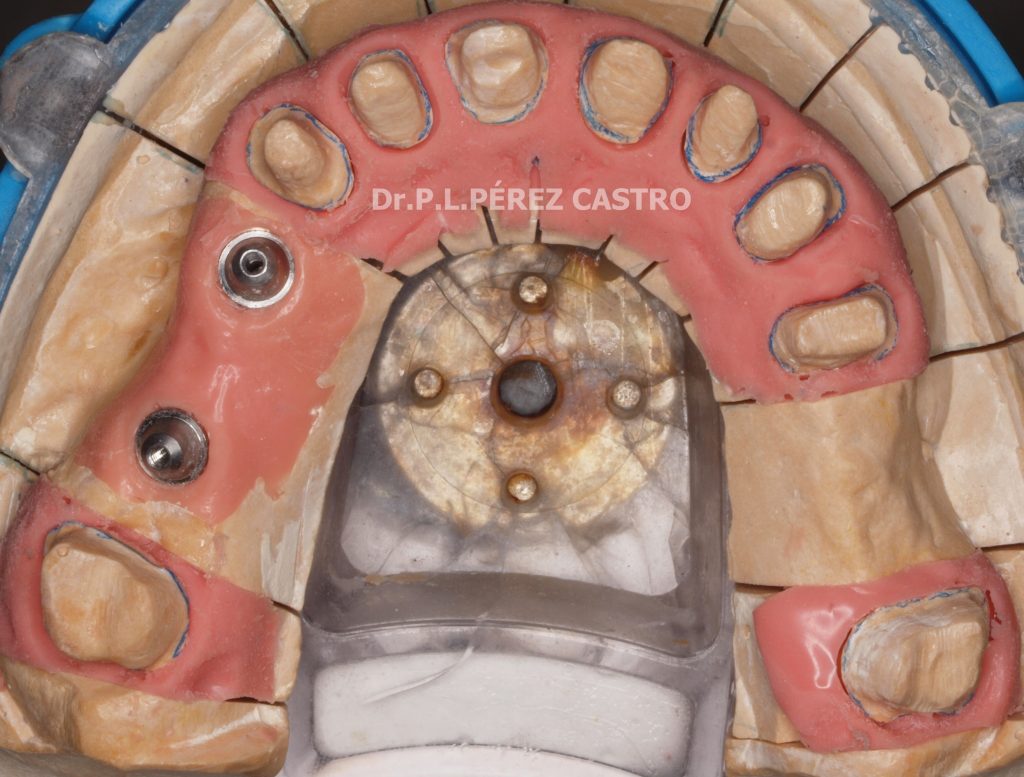Laboratorio de Preprótesis Dental: Dr. Pedro Luis Pérez Castro.